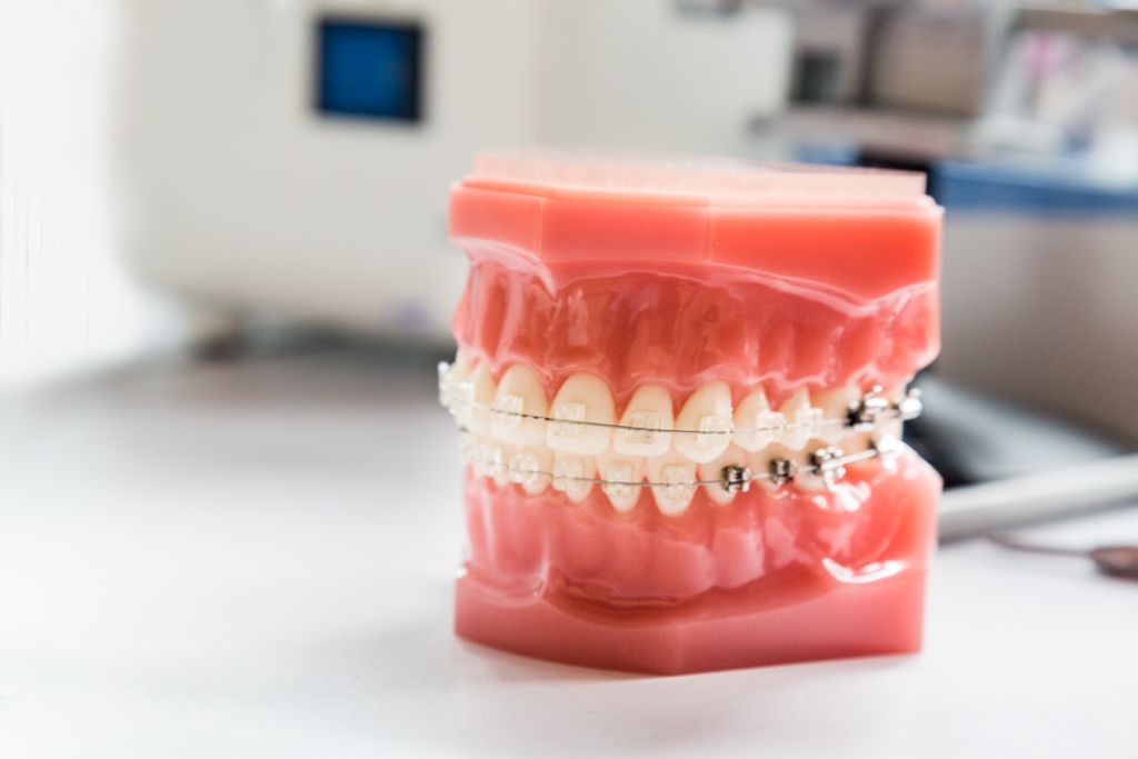 中島歯科クリニックの矯正の進め方