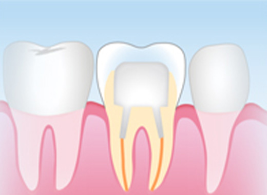 ファイバーコア
