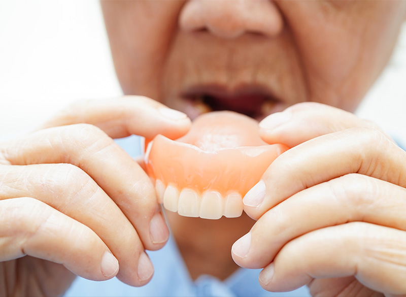 入れ歯