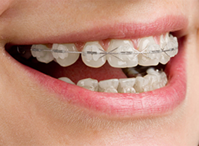 矯正歯科・小児矯正歯科