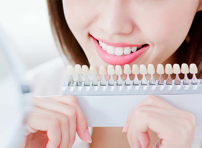 ホワイトニング